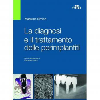 La diagnosi e il trattamento delle perimplantiti