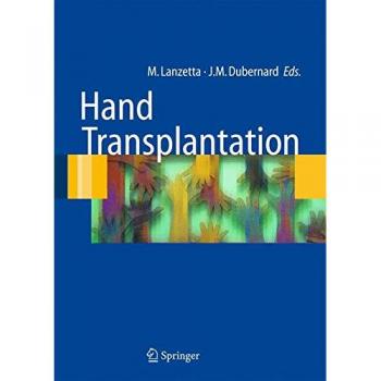 Hand transplantation. Con CD-ROM