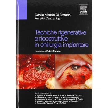 Tecniche rigenerative e ricostruttive in chirurgia implantare