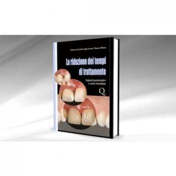 La riduzione dei tempi di trattamento. Impianti postestrattivi e carico immediato