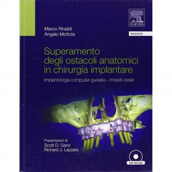 Superamento degli ostacoli anatomici in chirurgia implantare. Implantologia computer-guidata innesti ossei. Con DVD