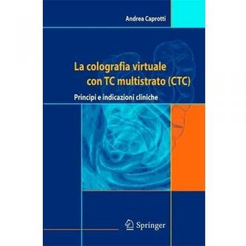 La colografia virtuale con TC multistrato. Principi e indicazioni cliniche