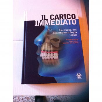 Il carico immediato. La nuova era dell'implantologia orale