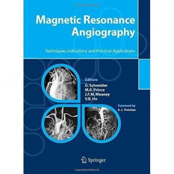 Magnetic resonance angiography. Techniques, indications and practical applications
