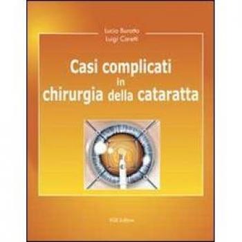 Casi complicati in chirurgia della cataratta